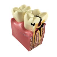 Modelo Dente Molar Corte Transversal ArtMed