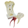 Modelo Anatómico Dente Molar Desmontado | Artmed