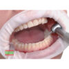 Afastador Labial Flexível | Toscana