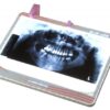 Negatoscópio Slim Led - Exemplo Posição | Essence Dental