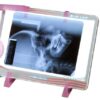 Negatoscópio Slim Led | Essence Dental