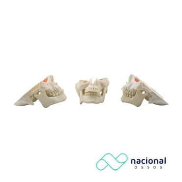 Kit Bucomaxilo Facial | Nacional Ossos
