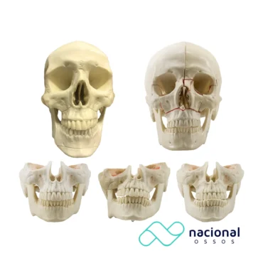 Kit CMF Solution - 5 Peças | Nacional Ossos