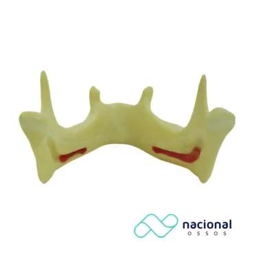 Mandíbula Com Pré-Molares | Nacional Ossos