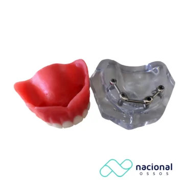 Maxila Acrilica Tri Clip | Nacional Ossos
