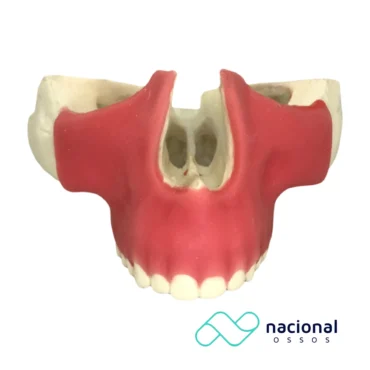 Maxila Para Gengivectomia 2 | Nacional Ossos
