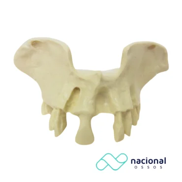 Maxila Pequena | Nacional Ossos