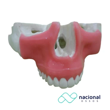 Maxila c/ Dentes e Gengiva | Nacional Ossos